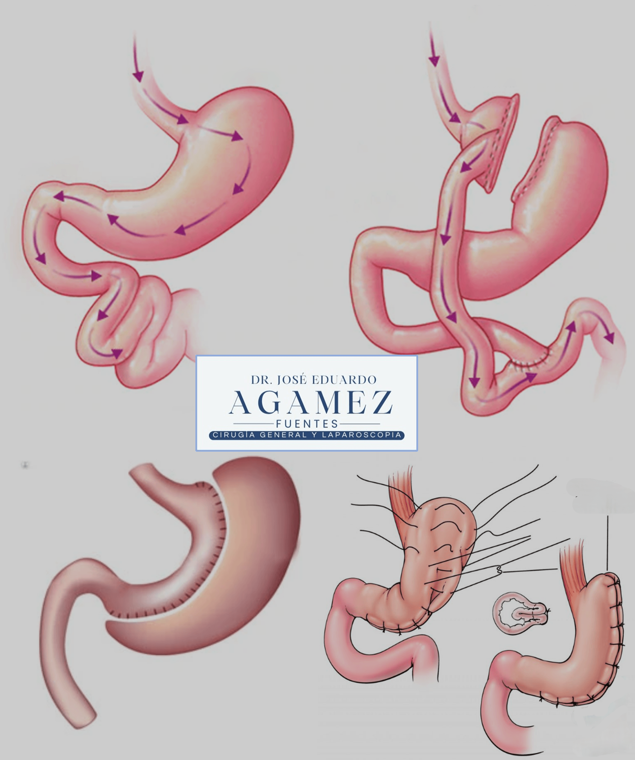 Técnicas disponibles realizadas por el Dr. José Agamez