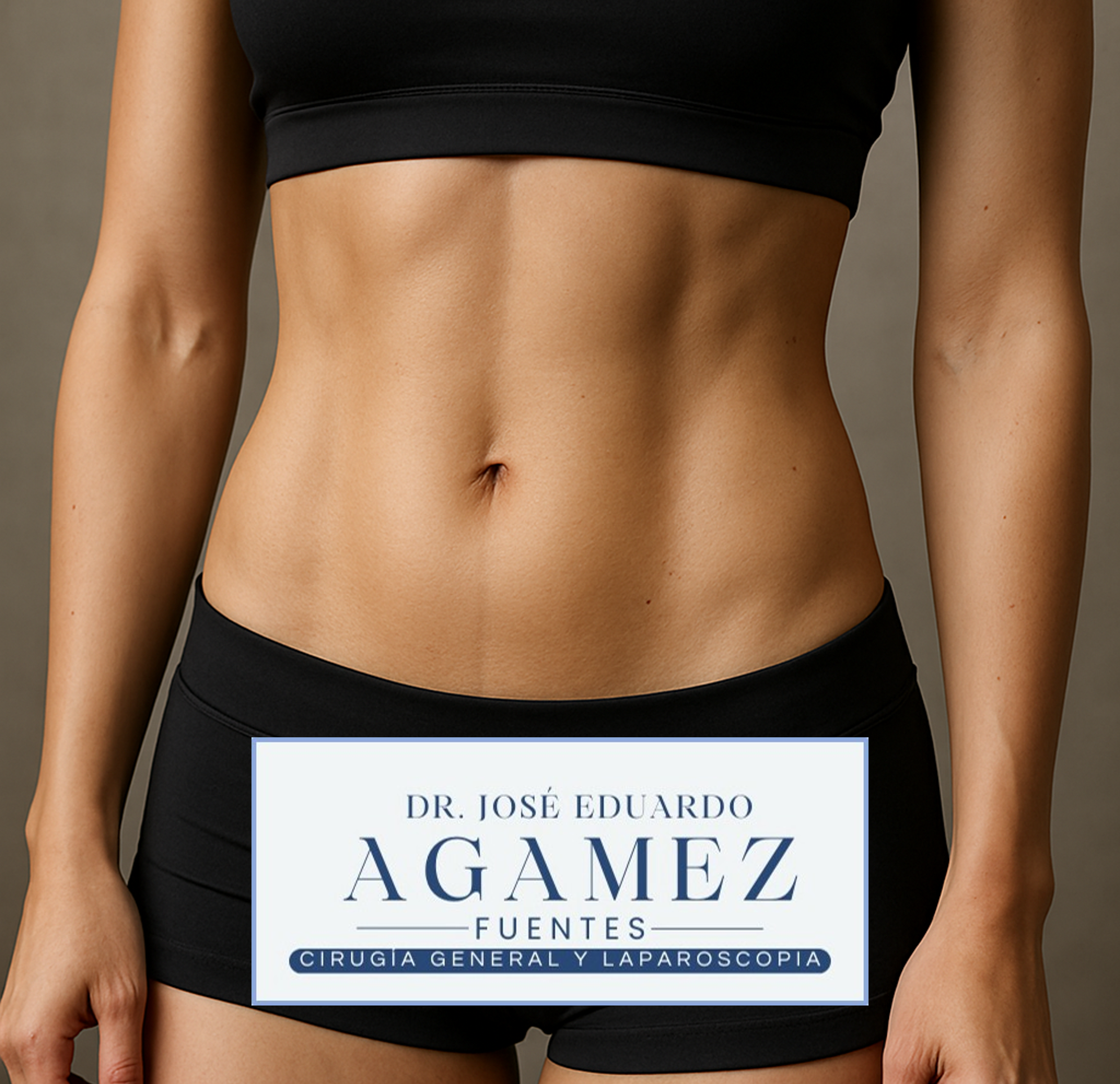 Lipoabdominoplastia por minima invasión (MILA) en medellín, Minimally Invasive LipoAbdominoplasty