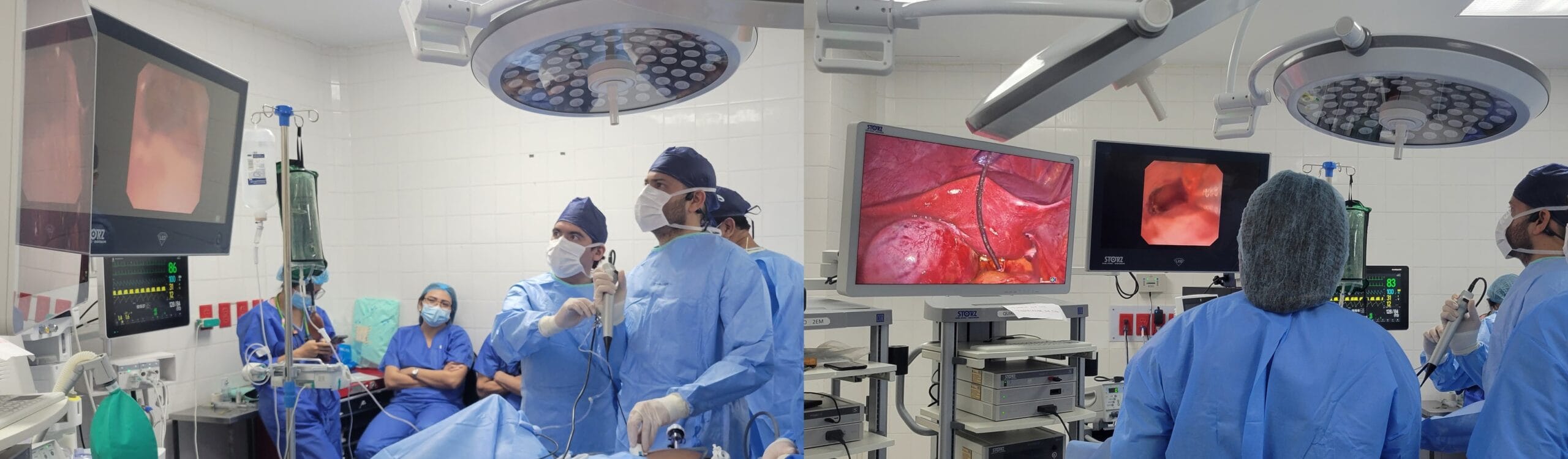 Experiencia internacional del Dr. José Agamez en El salvador exploración de vía biliar y colangioscopia intraoperatoria